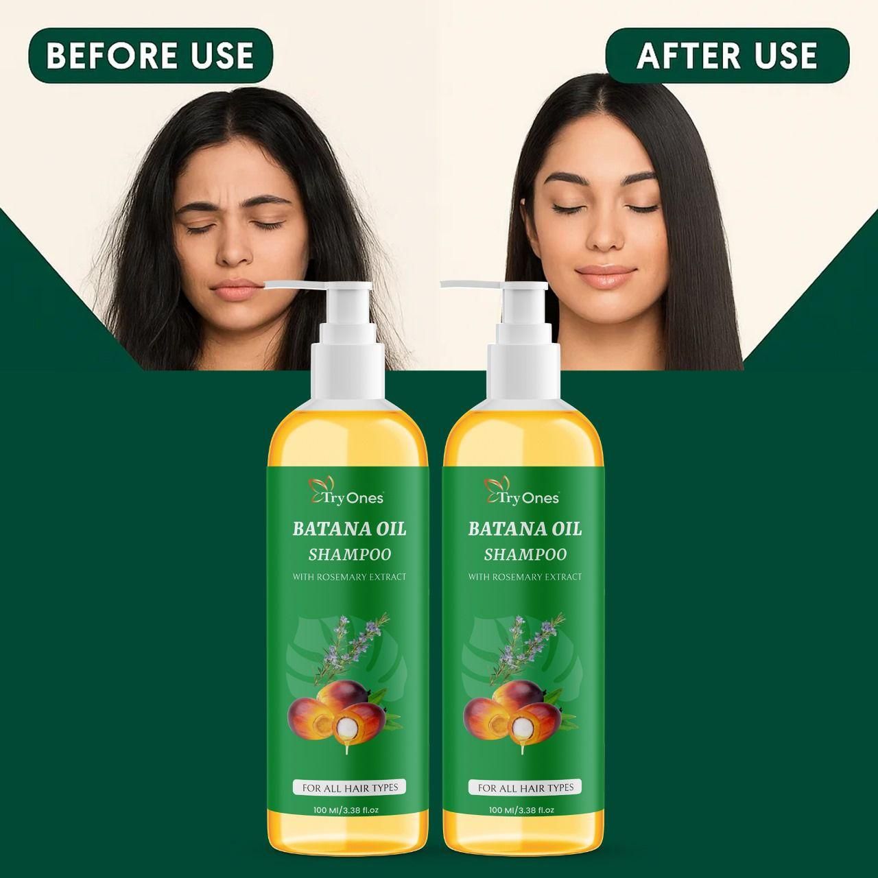 Batana Oil Shampoo for Hair Growth with Rosemary Extract 🌱✨ (100% Pure & Natural) - Buy 1 Get 1 Free🔥🔥