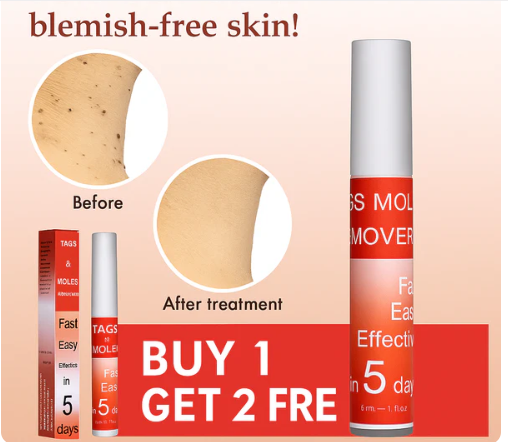 Tags & Moles Remover Buy 1 Get 1 FREE